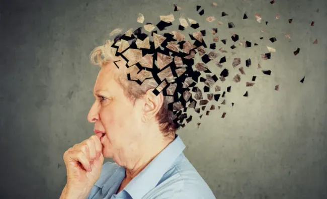 26072024-alzheimer-31079152601439804032421-41687411953352420905899.webp