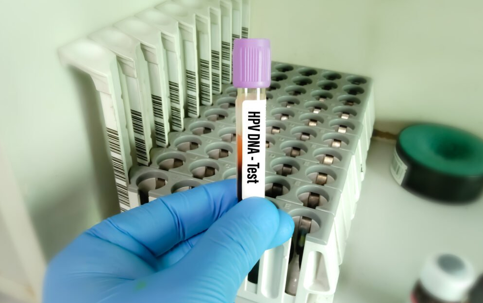 HPV1-1024x768.jpg