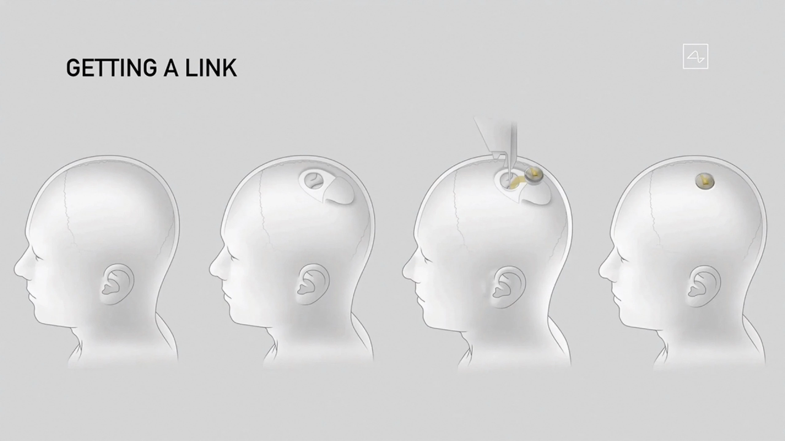 afp202008291wu27ev1highresmuskshowsoffprogressmergingbrainsandmachines-1706695002988627275688.webp