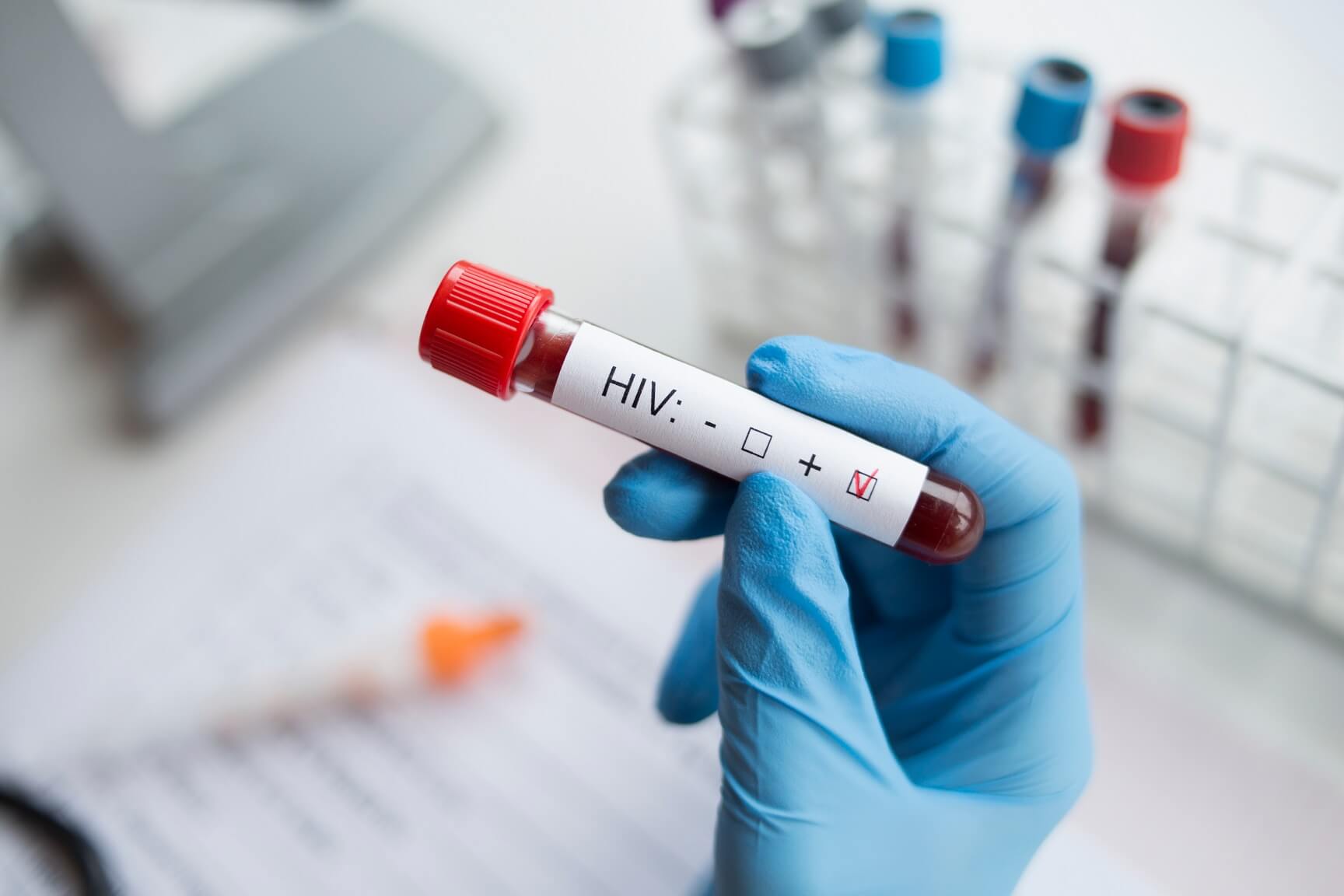 hiv_bioliek.jpg