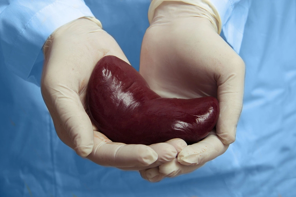 kidney-transplant-1751621625-1-6440-4526-1751621671.webp