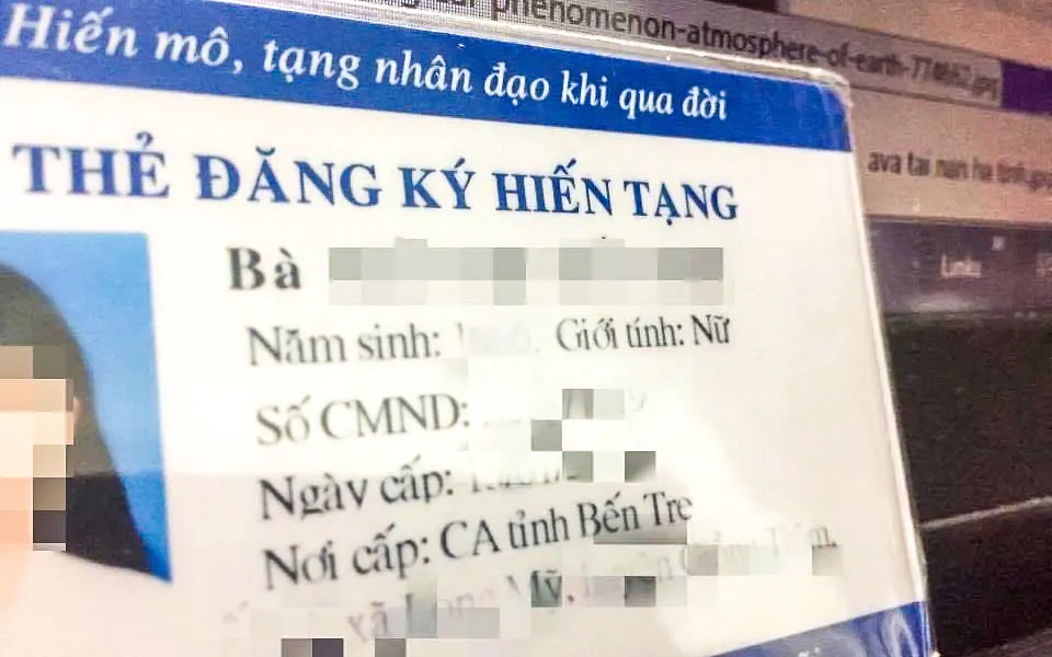 Đề xuất người dưới 18 tuổi được hiến tạng sau chết não - Ảnh: TTO