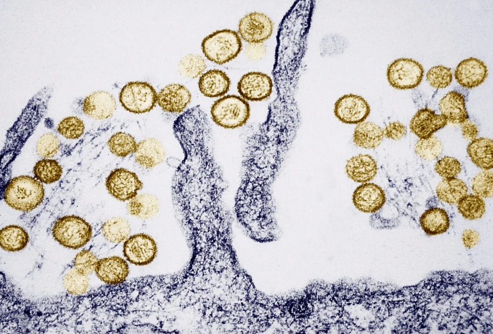 virus-hanta.jfif